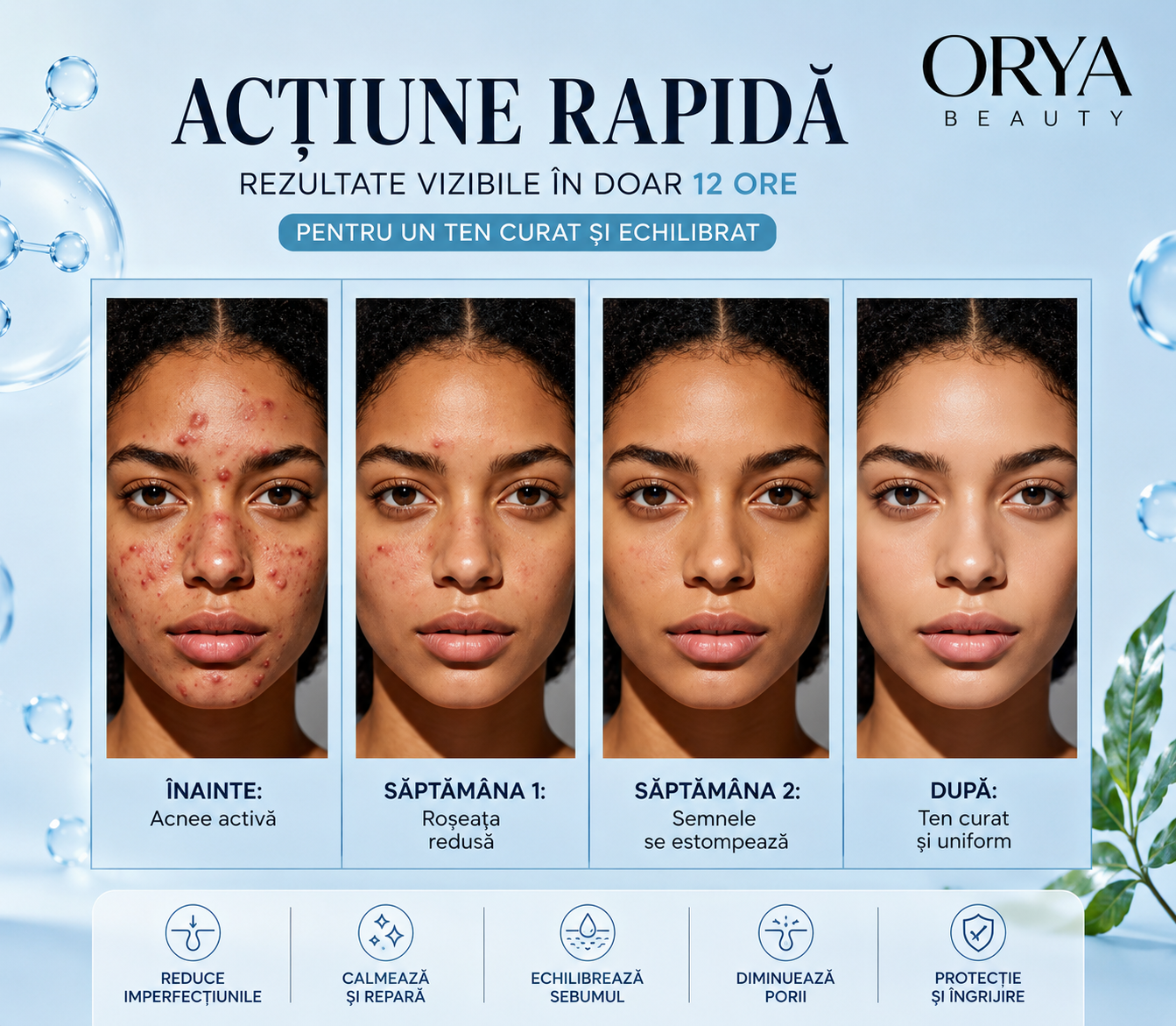 Orya Clear Skin Cream – Crema cu Acid Salicilic pentru Ten Predispus la Acnee